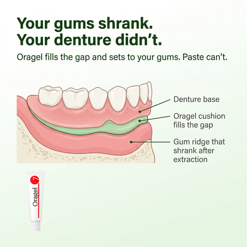 Maeva Oragel | Holds Your Loose Denture While Your Gums Heal