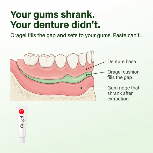 Maeva Oragel | Holds Your Loose Denture While Your Gums Heal